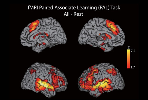 任务态功能磁共振（task-fMRI）数据处理
