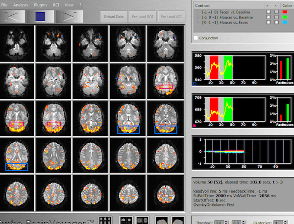 Turbo实时fMRI软件
